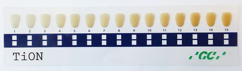 オフィスホワイトニングは最大8トーンほど白くなる